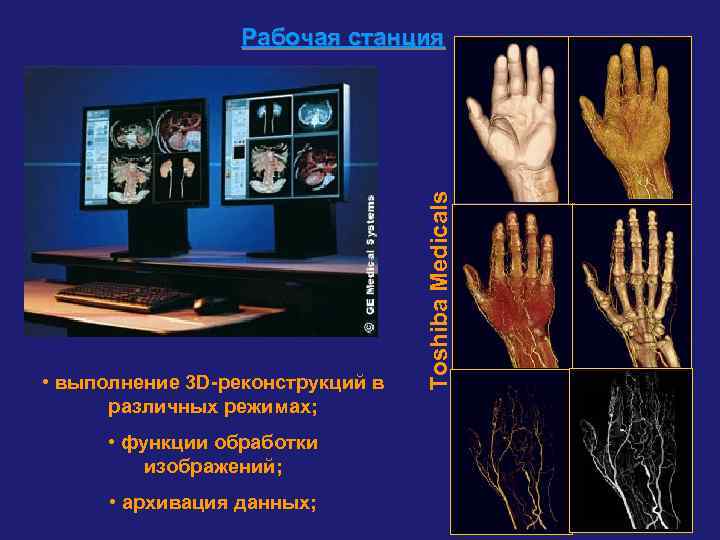    Рабочая станция    Toshiba Medicals • выполнение 3 D-реконструкций