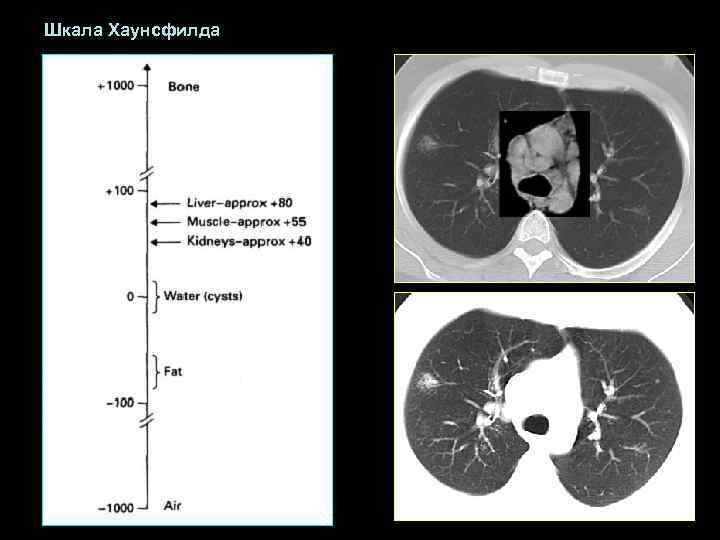 Шкала Хаунсфилда 