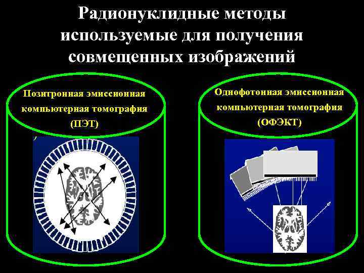    Радионуклидные методы  используемые для получения   совмещенных изображений Позитронная
