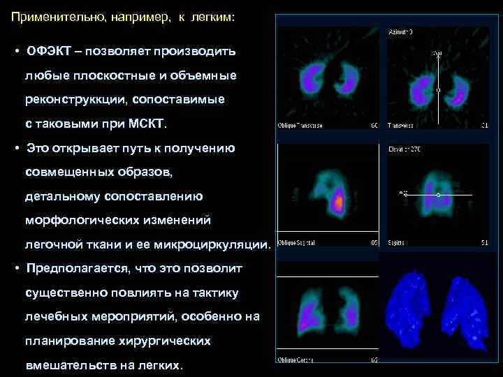 Применительно, например, к легким:  • ОФЭКТ – позволяет производить  любые плоскостные и