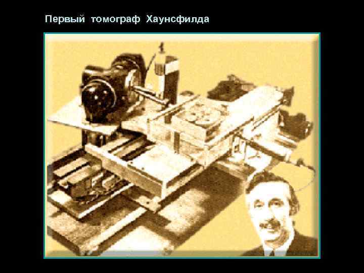 Первый томограф Хаунсфилда 