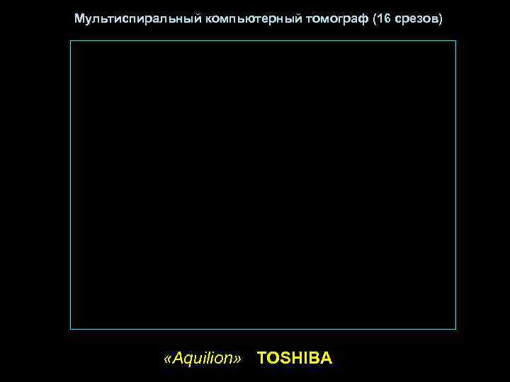 Мультиспиральный компьютерный томограф (16 срезов)   «Aquilion» TOSHIBA 