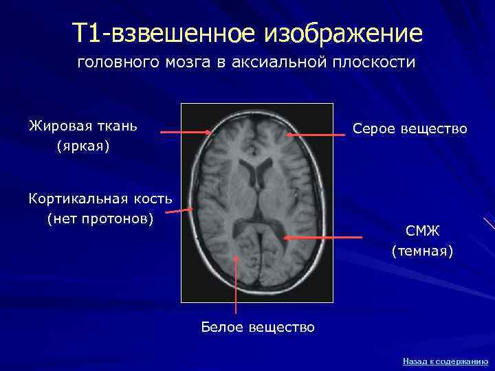 Т 1 -взвешенное изображение головного мозга в аксиальной плоскости Жировая ткань Т 1 -взвешенное изображение головного мозга в аксиальной плоскости Жировая ткань