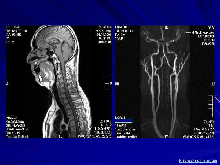 Назад к содержанию Назад к содержанию