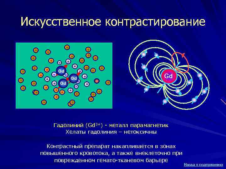 Искусственное контрастирование Gd Gd Гадолиний (Gd 3+) Искусственное контрастирование Gd Gd Гадолиний (Gd 3+)