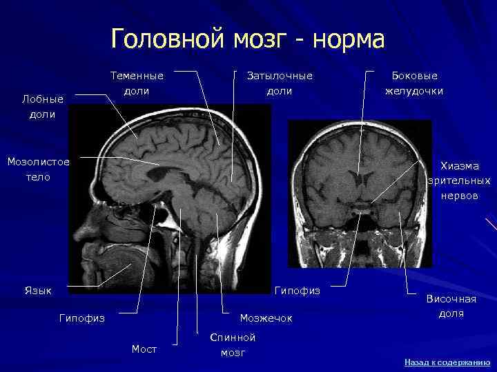 Головной мозг - норма Теменные Затылочные Головной мозг - норма Теменные Затылочные