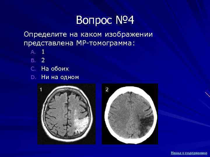 Вопрос № 4 Определите на каком изображении представлена МР-томограмма: Вопрос № 4 Определите на каком изображении представлена МР-томограмма: