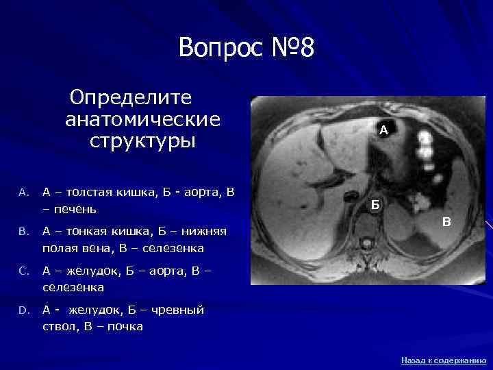 Вопрос № 8 Определите анатомические Вопрос № 8 Определите анатомические