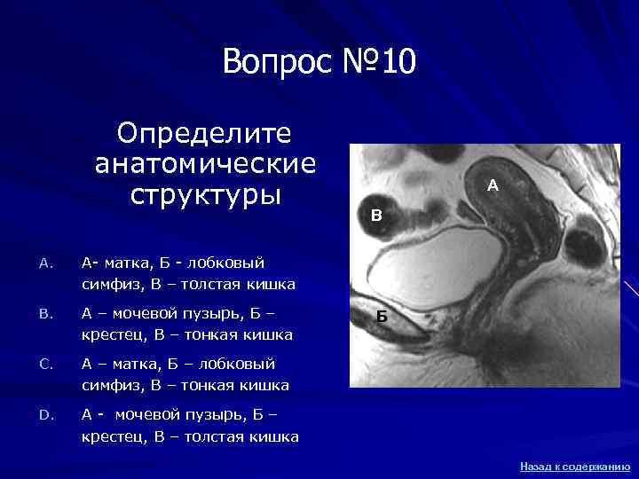 Вопрос № 10 Определите анатомические Вопрос № 10 Определите анатомические