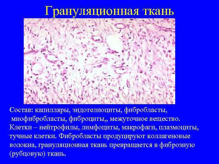    Грануляционная ткань Состав: капилляры, эндотелиоциты, фибробласты,  миофибробласты, фиброциты, , межуточное