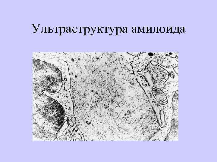 Ультраструктура амилоида 