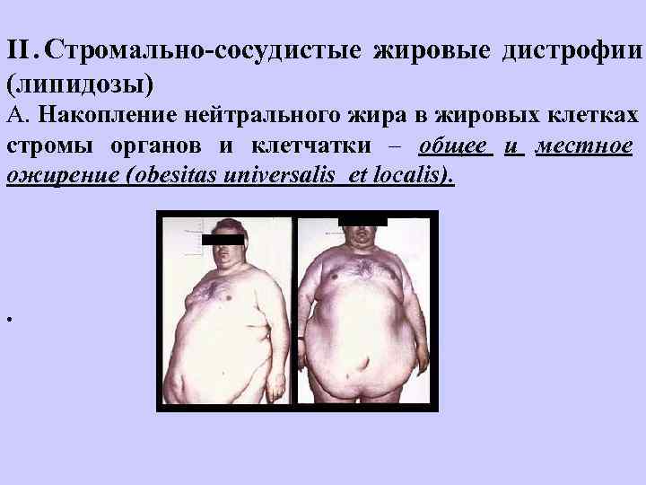 II. Стромально-сосудистые жировые дистрофии     (липидозы) А. Накопление нейтрального жира в