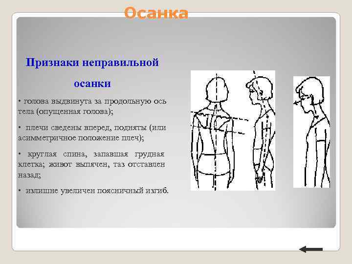 Осанка Признаки неправильной осанки • Осанка Признаки неправильной осанки •