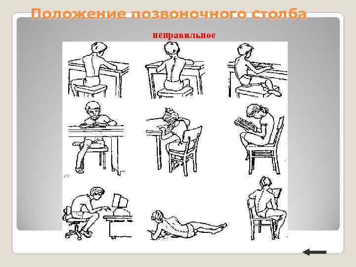 Положение позвоночного столба неправильное Положение позвоночного столба неправильное