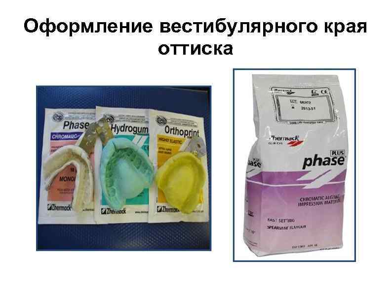 Оформление вестибулярного края  оттиска 