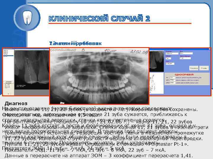    12 -летний ребенок    7 -летний ребенок  