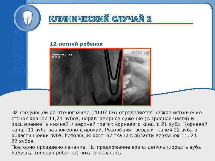    12 -летний ребенок    Пробный текст На следующей рентгенограмме