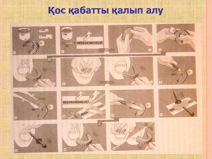 Қос қабатты қалып алу 