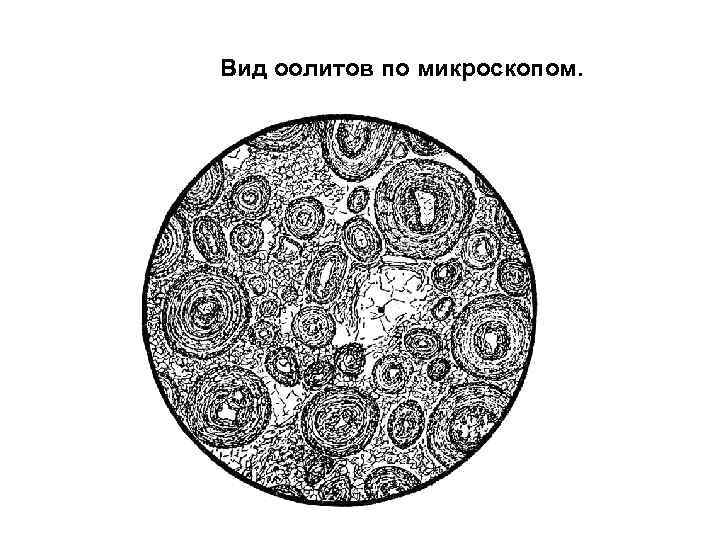 Вид оолитов по микроскопом. 