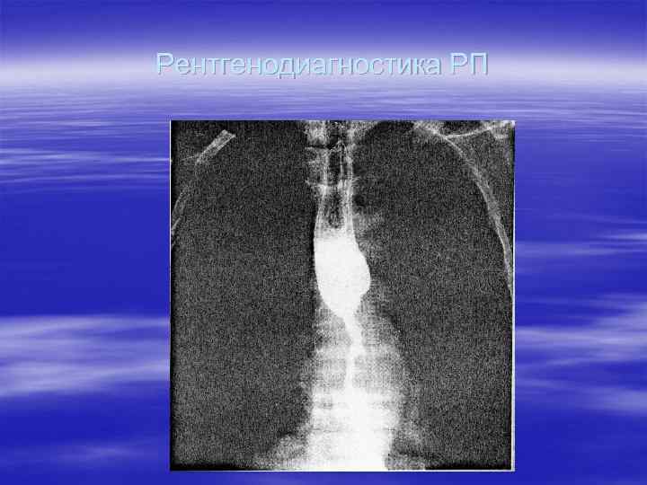 Рентгенодиагностика РП 