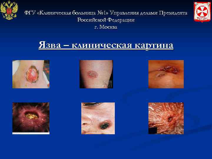 ФГУ «Клиническая больница № 1» Управления делами Президента    Российской Федерации 