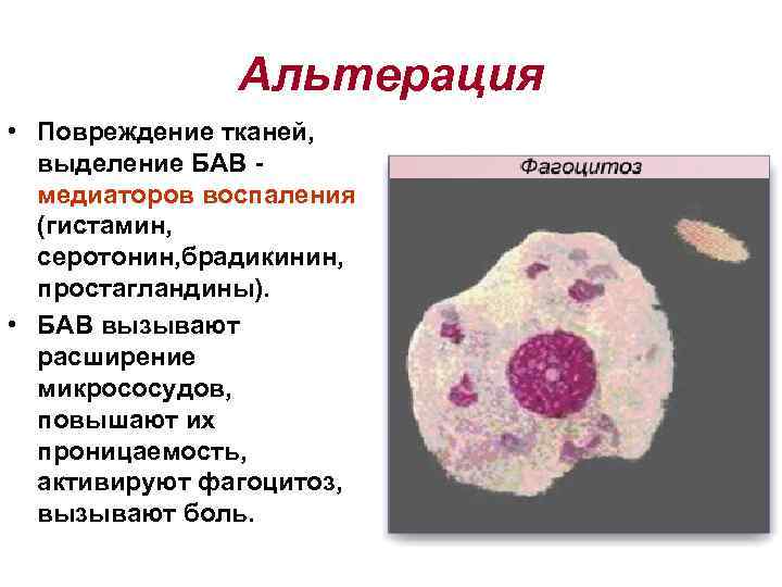 Воспалительная ткань. Альтерация— повреждение ткани. Альтерация это в патологии. Альтерация воспаление. Альтерация патология воспаление.