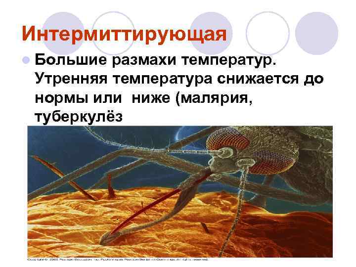 Интермиттирующая l Большие размахи температур. Утренняя температура снижается до нормы или ниже (малярия, Интермиттирующая l Большие размахи температур. Утренняя температура снижается до нормы или ниже (малярия,