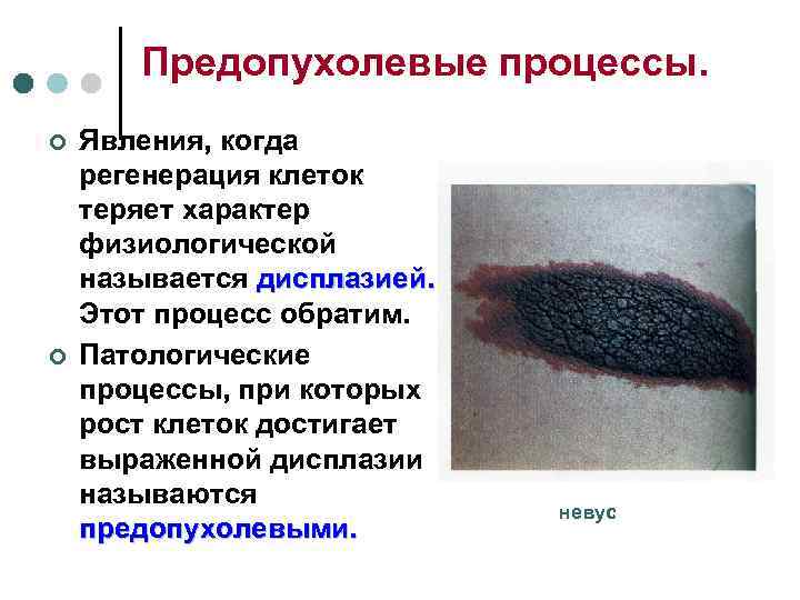   Предопухолевые процессы. ¢  Явления, когда регенерация клеток теряет характер физиологической называется