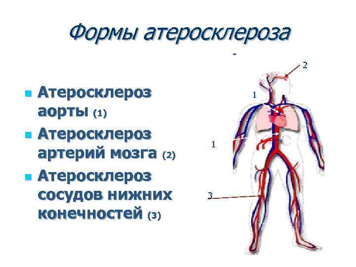 Формы атеросклероза 2 n n n Атеросклероз аорты (1) Атеросклероз артерий мозга (2) Атеросклероз