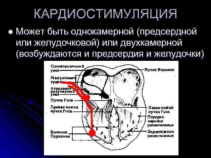 КАРДИОСТИМУЛЯЦИЯ l Может быть однокамерной (предсердной или желудочковой) или двухкамерной (возбуждаются КАРДИОСТИМУЛЯЦИЯ l Может быть однокамерной (предсердной или желудочковой) или двухкамерной (возбуждаются