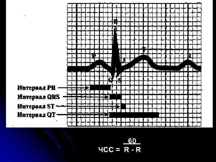60 ЧСС = R - R 60 ЧСС = R - R