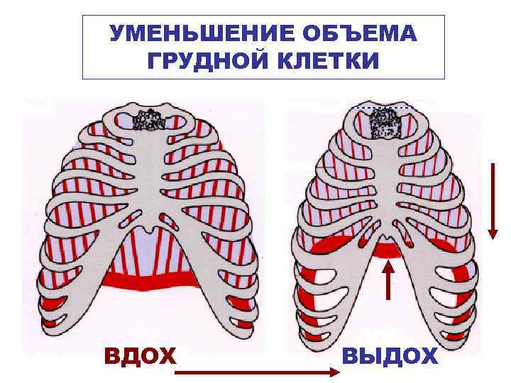 УМЕНЬШЕНИЕ ОБЪЕМА  ГРУДНОЙ КЛЕТКИ ВДОХ  ВЫДОХ 