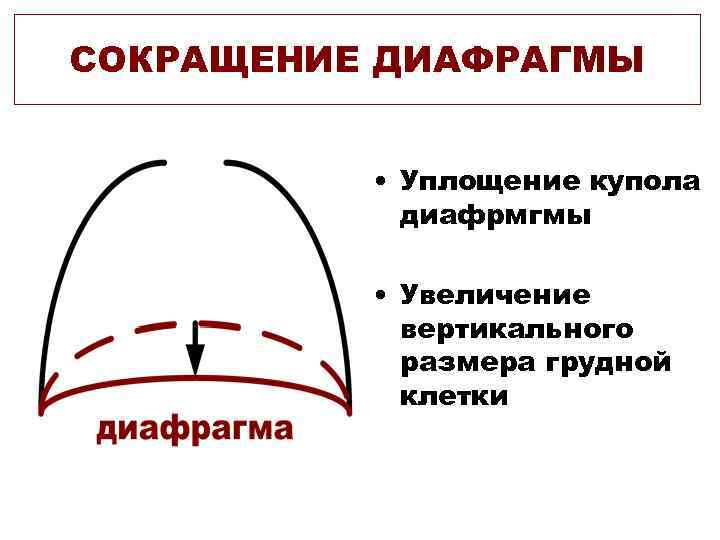 СОКРАЩЕНИЕ ДИАФРАГМЫ   • Уплощение купола   диафрмгмы   • Увеличение