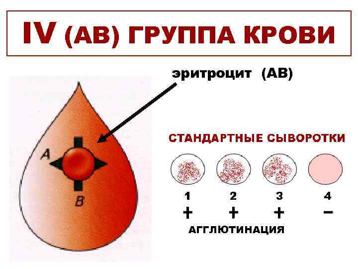IV (АB) ГРУППА КРОВИ   эритроцит (АВ)    АГГЛЮТИНАЦИЯ 