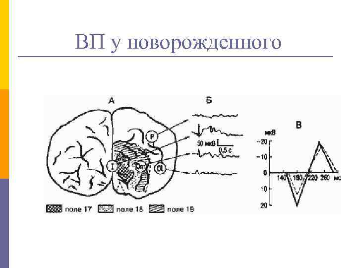 ВП у новорожденного 