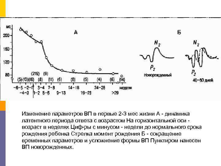 Изменение параметров ВП в первые 2 3 мес жизни А  динамика латентного периода
