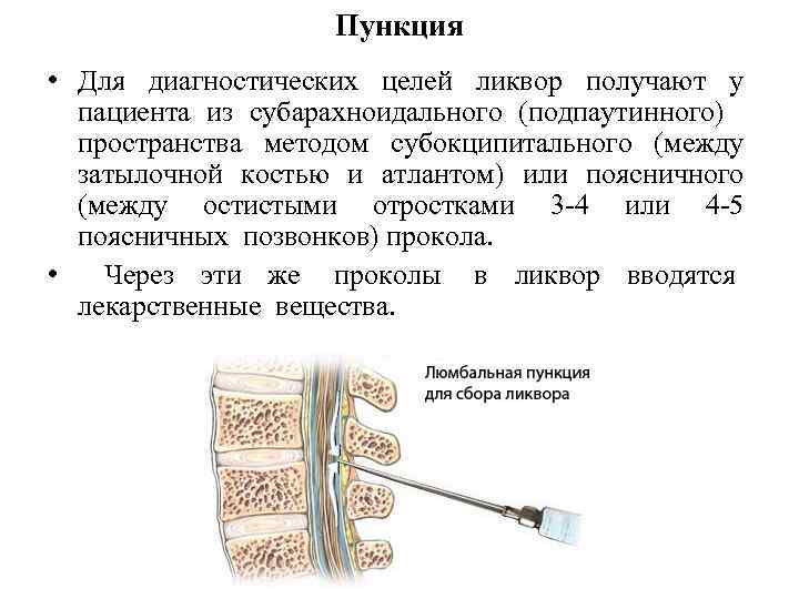      Пункция • Для диагностических целей ликвор получают у 