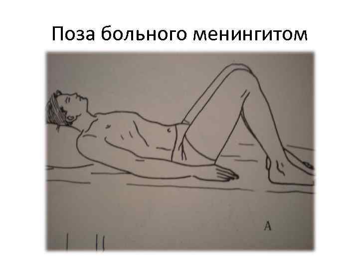 Поза больного менингитом 