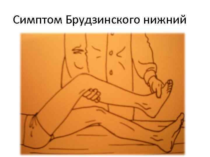 Симптом Брудзинского нижний 