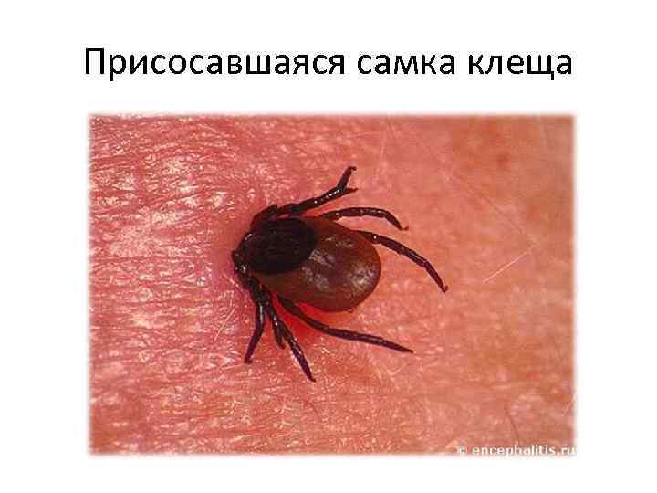Присосавшаяся самка клеща 