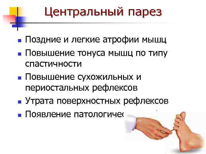   Центральный парез n  Поздние и легкие атрофии мышц n  Повышение