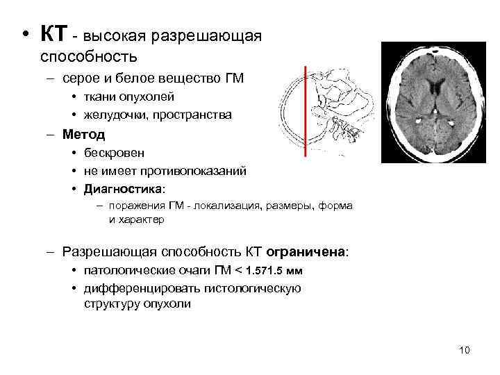 • КТ - высокая разрешающая способность – серое и белое вещество • КТ - высокая разрешающая способность – серое и белое вещество