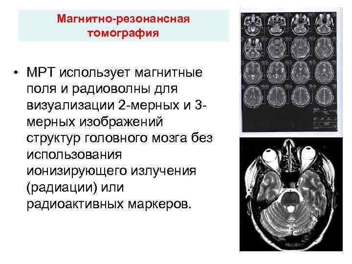 Магнитно-резонансная томография • МРТ использует магнитные поля и радиоволны для Магнитно-резонансная томография • МРТ использует магнитные поля и радиоволны для