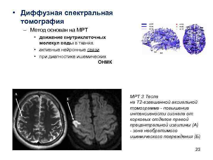 • Диффузная спектральная томография – Метод основан на МРТ • • Диффузная спектральная томография – Метод основан на МРТ •