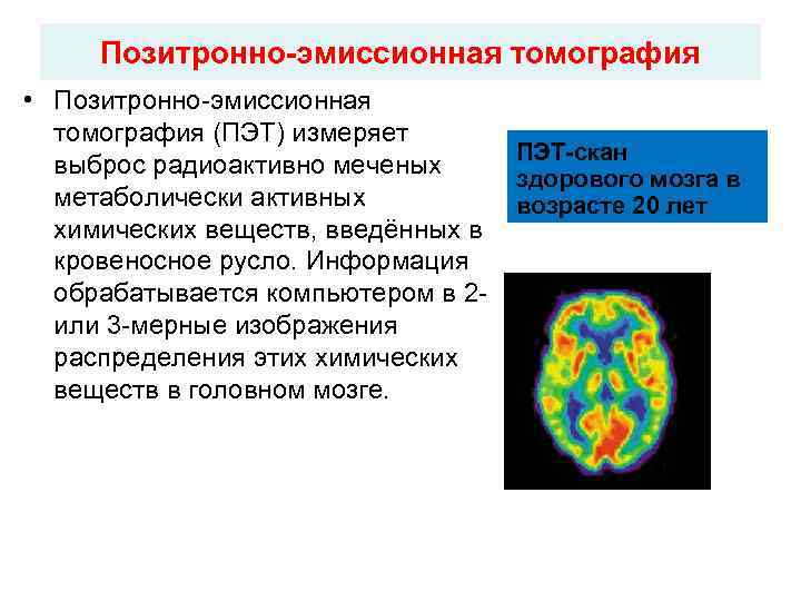 Метаболическая активность на пэт кт что это