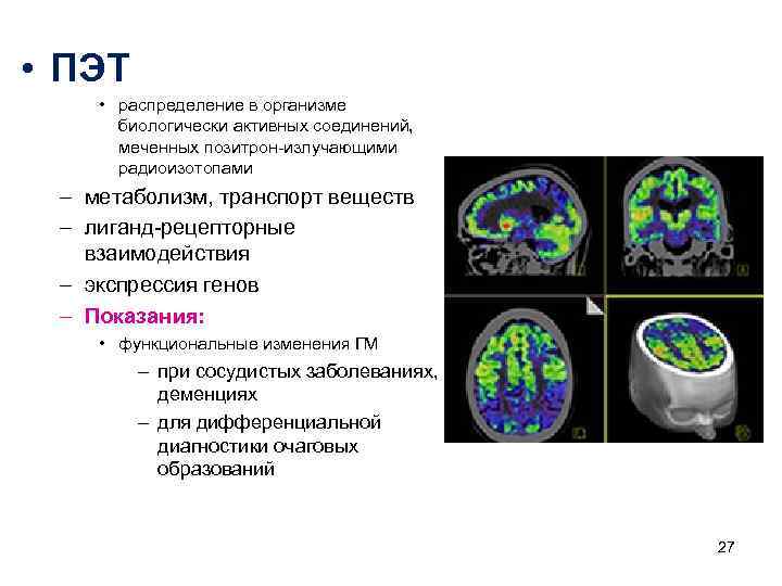 • ПЭТ • распределение в организме биологически активных соединений, • ПЭТ • распределение в организме биологически активных соединений,
