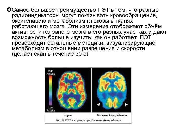 Самое большое преимущество ПЭТ в том, что разные радиоиндикаторы могут показывать кровообращение, Самое большое преимущество ПЭТ в том, что разные радиоиндикаторы могут показывать кровообращение,