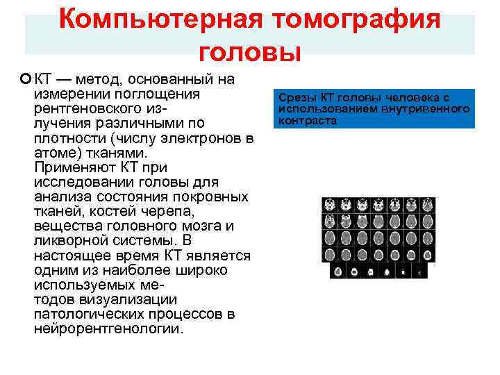 Компьютерная томография головы КТ — метод, основанный на Компьютерная томография головы КТ — метод, основанный на