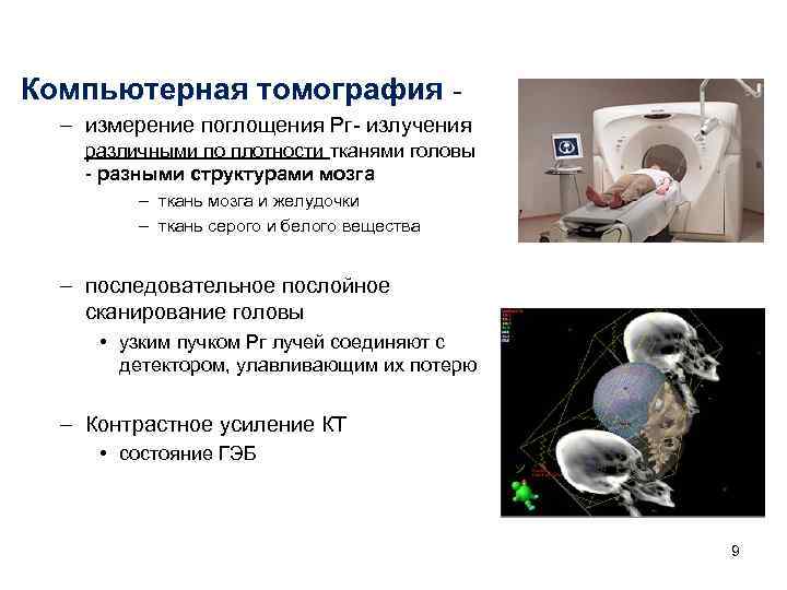 Компьютерная томография - – измерение поглощения Рг- излучения различными по плотности тканями головы Компьютерная томография - – измерение поглощения Рг- излучения различными по плотности тканями головы