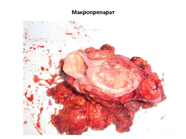 Макропрепарат 